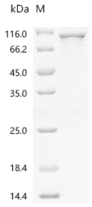 SDS-PAGE