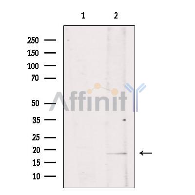 Валидация Affinity DF6316 - 17642