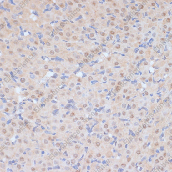 Иммуногистохимия, CDK9, ткань яичника крысы