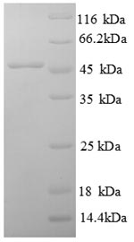 SDS-PAGE