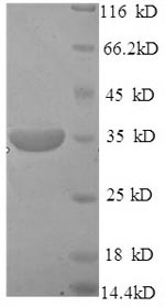 SDS-PAGE