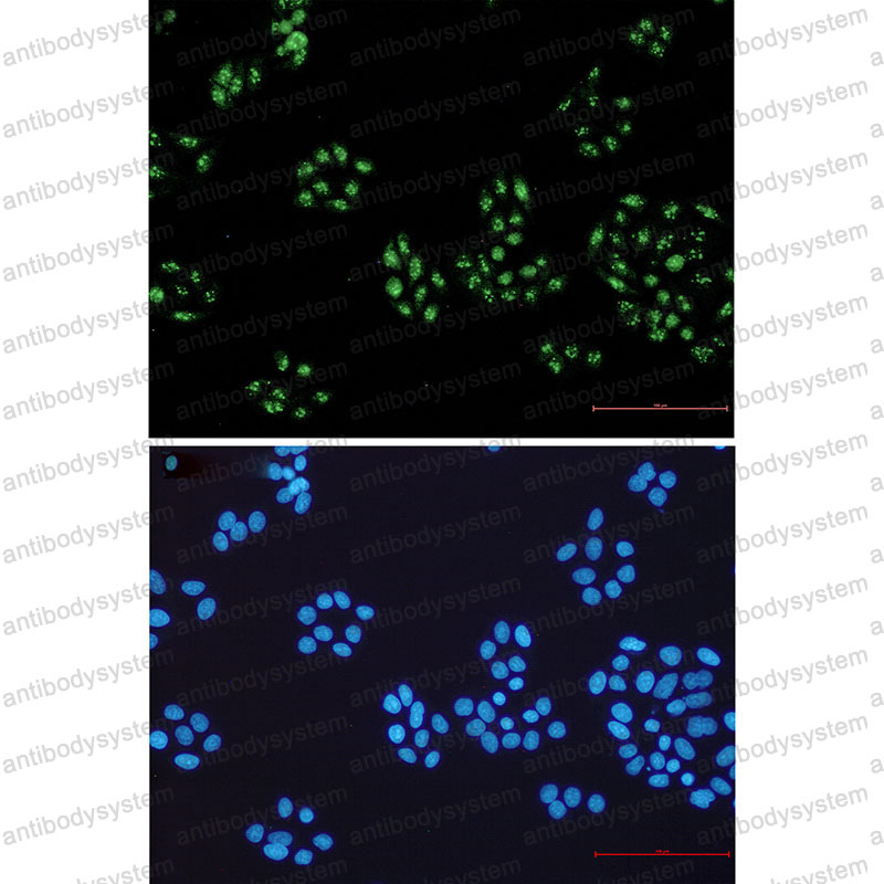 Валидация IF - AntibodySystem RHG93701