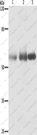 Вестерн-блоттинг, NECTIN1, ткань рака шейки матки человека, фиброзной гистиоцитомы ноги и плода