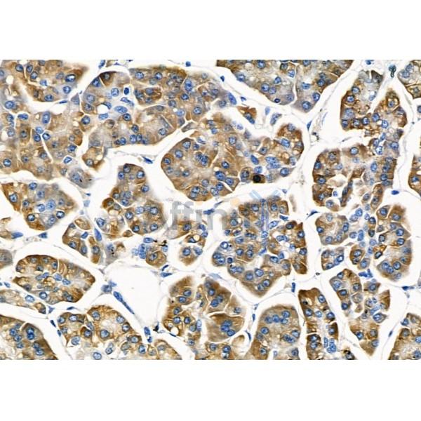 Валидация Affinity AF9185 - 5008