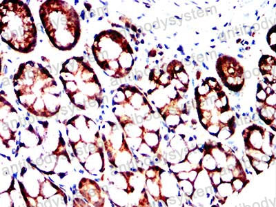 Валидация AntibodySystem RHA52803 (159)