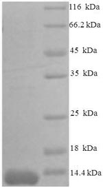 SDS-PAGE