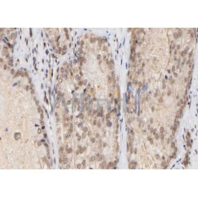 Валидация Affinity AF7925 - 4674