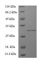 SDS-PAGE