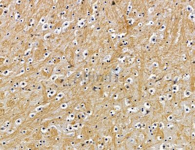 Валидация Affinity DF15575 - 11990