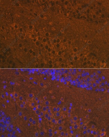 Иммунофлуоресценция, Mu Opioid Receptor, ткань мозга мыши