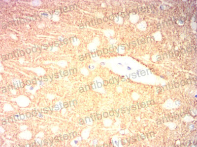 Валидация AntibodySystem RHF56704 (2571)