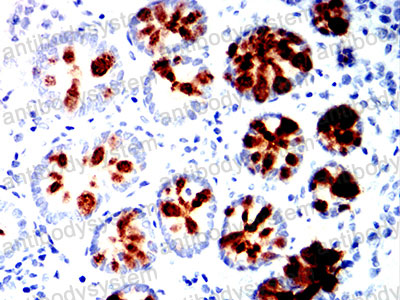 Валидация AntibodySystem RHF96003
