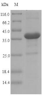 SDS-PAGE