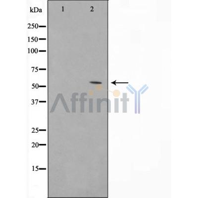 Валидация Affinity AF5462 - 3115