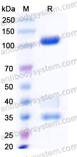 AHA46002, SDS-PAGE