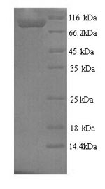 SDS-PAGE