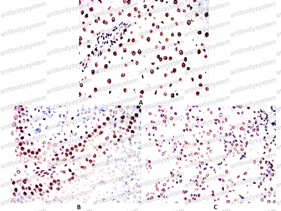 Валидация AntibodySystem RHE37705 (2130)