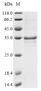 SDS-PAGE