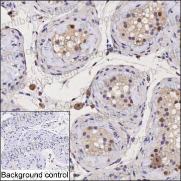 Валидация AntibodySystem RHF80203
