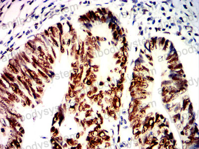 Валидация AntibodySystem RHE40507