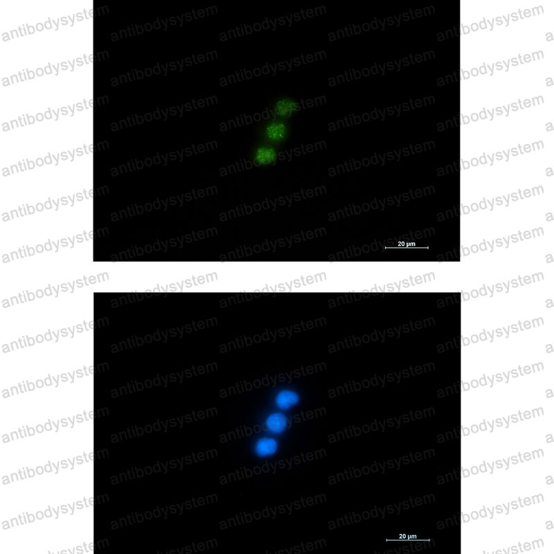 Валидация IF - AntibodySystem RHK76101