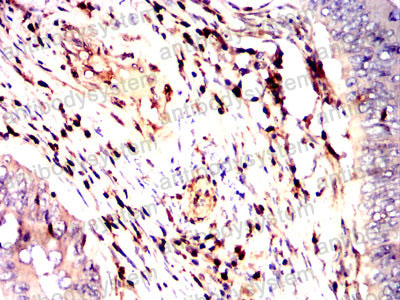 Валидация AntibodySystem RHD71003 (1750)