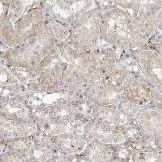 Валидация AssayVector ARM2354(4099)