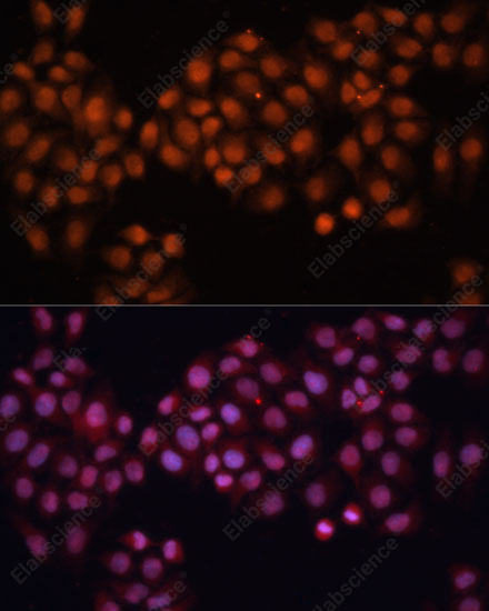 Иммунофлуоресценция, CDC25A, клетки HeLa