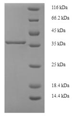 SDS-PAGE