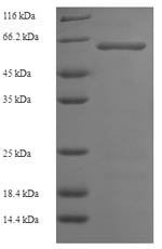 SDS-PAGE