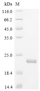 SDS-PAGE