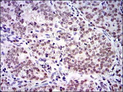 Валидация AntibodySystem RHF59703