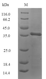 SDS-PAGE