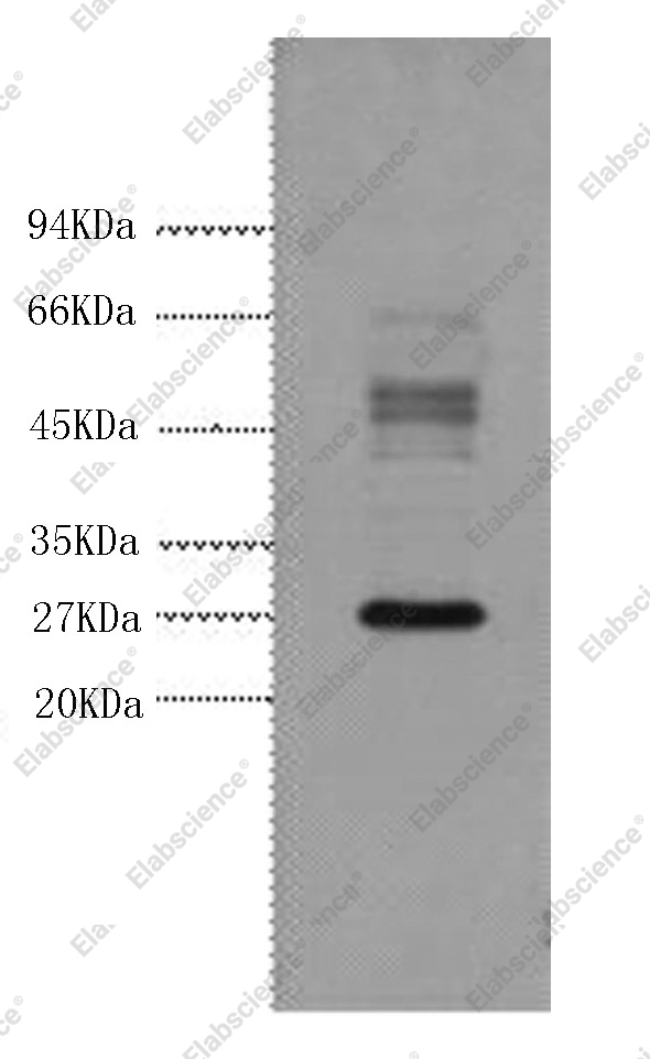 Вестерн-блоттинг, Galectin 3, клетки HeLa
