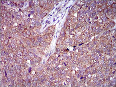 Валидация AntibodySystem RHA36302