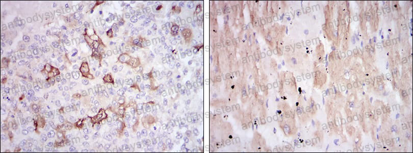 Валидация AntibodySystem RHC10502