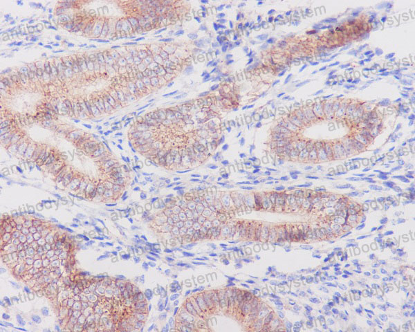 Валидация AntibodySystem RHB37201