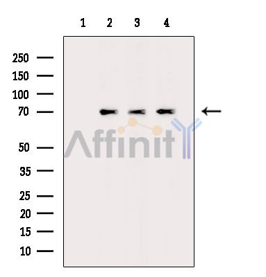 Валидация Affinity DF15125 - 11378