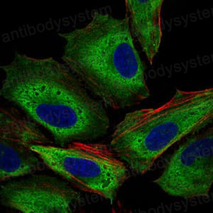 Валидация IF - AntibodySystem RHD72502