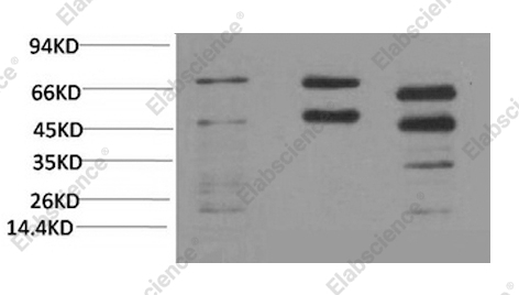 Вестерн-блоттинг, Phosphoserine, клетки HeLa и ткань мозга крысы и мыши