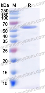 YHF49302, SDS-PAGE