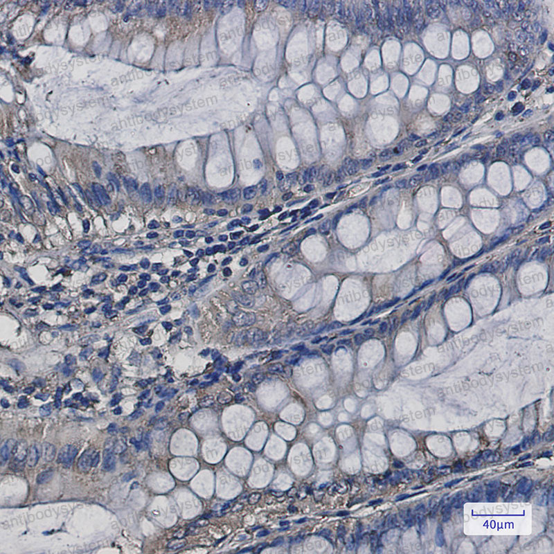 Валидация AntibodySystem RHD18801