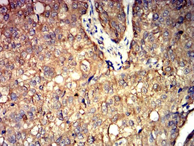 Валидация AntibodySystem RHC06002 (578)