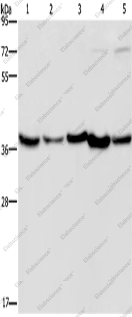 Вестерн-блоттинг, DNAJB4, ткань печени плода человека, скелетная мышца и сердце мыши, клетки HeLa и Jurkat