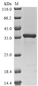 SDS-PAGE