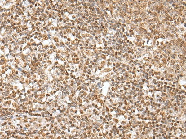 Иммуногистохимия, ZNF354A, ткань миндалин человека