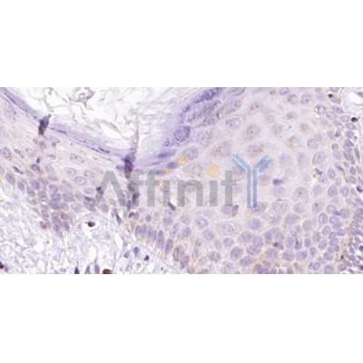 Валидация Affinity DF2526 - 13184