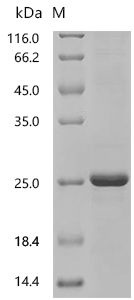 SDS-PAGE