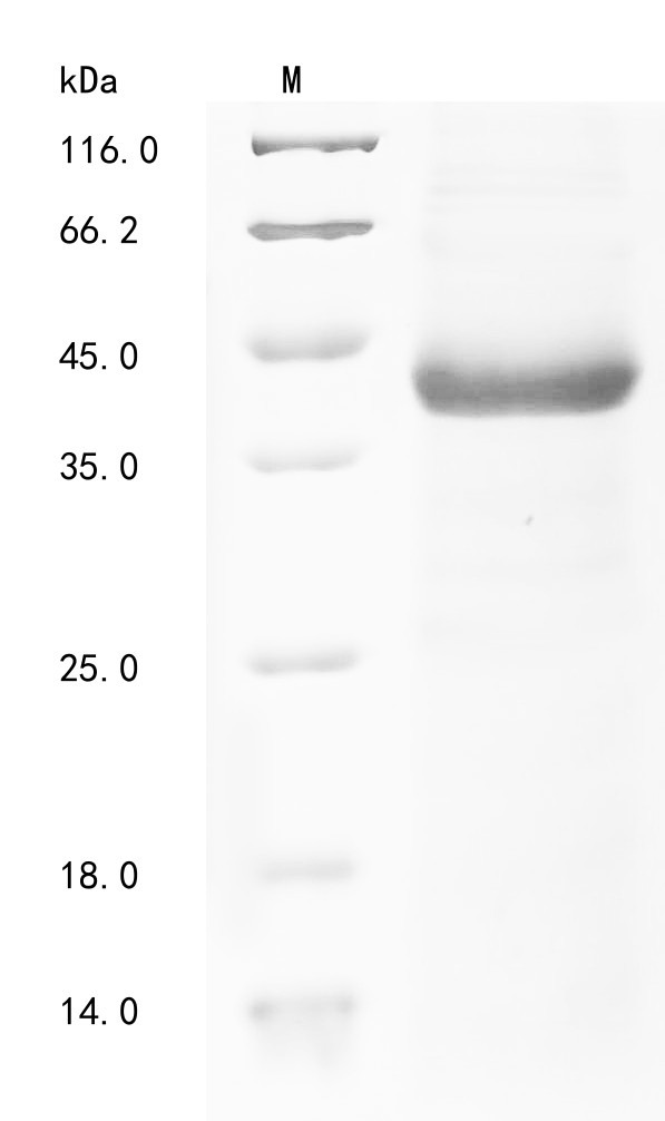 SDS-PAGE