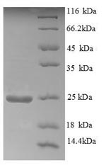 SDS-PAGE